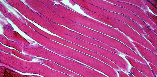 Bild zu Neuromuskuläre Erkrankungen - Therapiestudien bei Muskel­dystrophie Duchenne