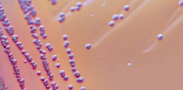 Bild: fotolia - sinhyu Bild zu Multiresistente Erreger - Infektionspräventives Vorgehen bei MRGN-Nachweis im Kindesalter