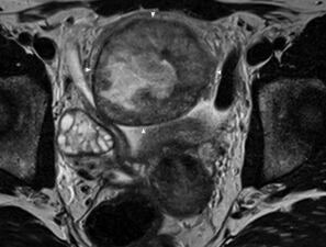 Bild zu Der diagnostische Blick - 15-jähriges Mädchen mit subakutem Bauchschmerz und Infektzeichen