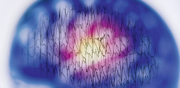 Bild zu Epilepsie - Epileptische Enzephalopathien