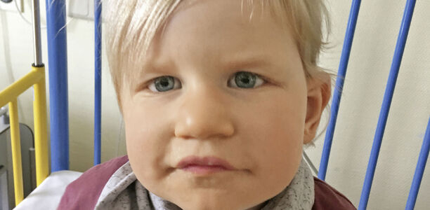 Bild zu Der diagnostische Blick - Ein 20 Monate altes Mädchen mit Dysmorphie-Retardierungs-Syndrom