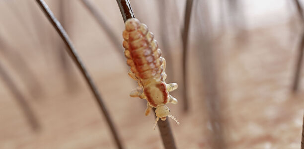 Bild: SciePro - AdobeStock Bild zu Parasiten - Pediculosis capitis und Skabies: Übersicht zu Epidemiologie, Diagnose und Therapie