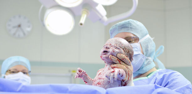 Bild zu Beatmung bei Neugeborenen - Einsatz von Larynx-Masken während der neonatalen Reanimation?