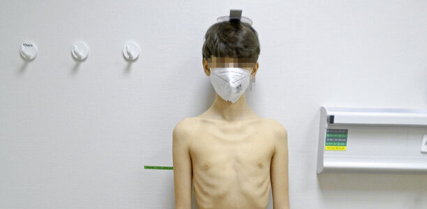 Bild: I. Schmitz Bild zu Der diagnotische Blick - Ein 15-jähriger Junge mit Untergewicht und Ikterus