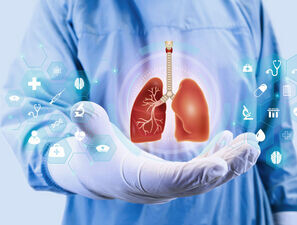 Bild zu Studie - Idealer Parameter zur Identifikation einer Mykoplasmen-Pneumonie?