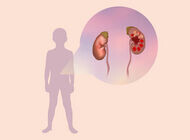 Bild zu Antibiotika-Serie der YoungDGPI - Ambulante Standardbehandlung der Pyelonephritis