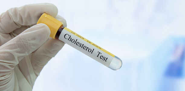 Bild zu Hypercholesterinämie - Bessere Früherkennung bei Kindern durch flächendeckendes LDL-Screening?