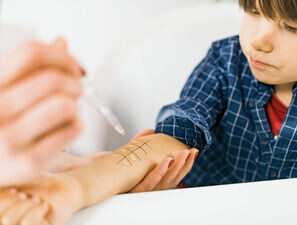 Bild zu Allergien bei Kindern - Allergologie fast nur noch ein Hobby?