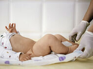 Bild zu Antibiotika-Serie der YoungDGPI - Therapie der Balanitis – eigentlich banal, oder?