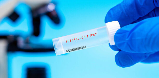 Bild zu Tuberkulose-Therapie - DGSPJ-Preis für transkulturelle Pädiatrie geht an Sophia Galle