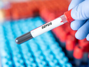 Bild zu Sepsis-Update - Was für die kinderärztliche Praxis wichtig ist